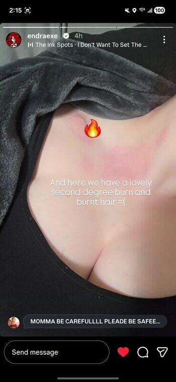 Endra exe leaked private photo uncensored HD quality